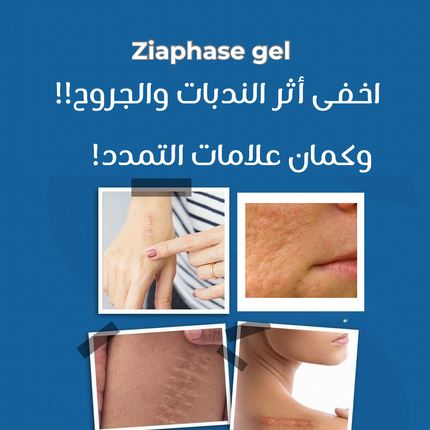 Ziaphase Anti-Scar Gel – 50 g  – Special Offer (4 Packs)